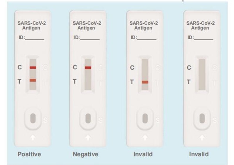 SARS-COV-2 Antijen Testleri Dezavantajlar