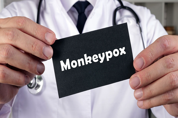 Hızlı Antijen Tespit Testi Strep: Monkeypox hakkında bilmeniz gereken beş şey