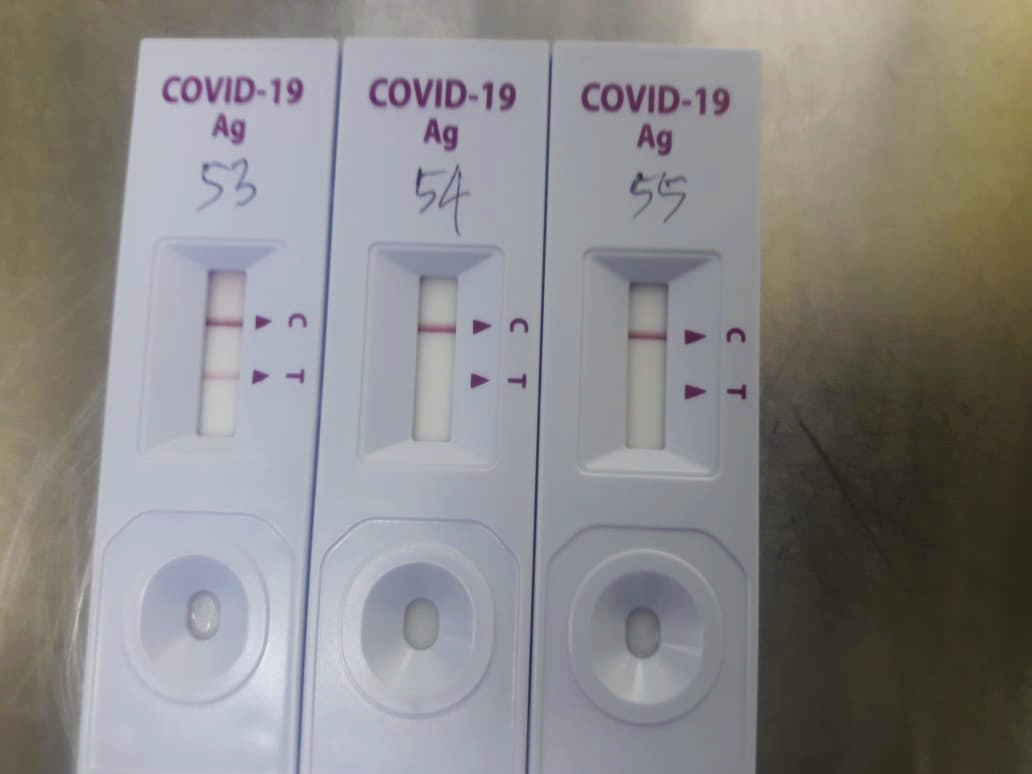 PCR vs Antijen Testi: Hangi Covid-19 testi benim için doğru?