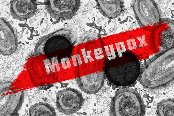 Swab testi antijen harga: Birçok ülkede 1000'den fazla Monkeypox vakası teşhis edildi!